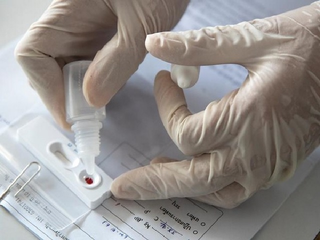 Steroid Dexamethasone helps in the treatment of COVID-19 patients: UK researchers